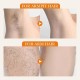 کرم مو بر و روشن کننده ویتامین C سادور SADOER VITAMIN HAIR REMOVAL WHITENING CREAM