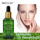 سرم ضد جوش و آکنه چای سبز بریلی BREYLEE ACNE TREATMENT SERUM