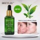 سرم ضد جوش و آکنه چای سبز بریلی BREYLEE ACNE TREATMENT SERUM
