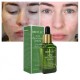 سرم ضد جوش و آکنه چای سبز بریلی BREYLEE ACNE TREATMENT SERUM