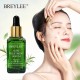 سرم ضد جوش و آکنه چای سبز بریلی BREYLEE ACNE TREATMENT SERUM