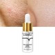 سرم کوچک کننده منافذ لانبنا LANBENA PORE SOLUTION SERUM
