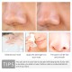 سرم کوچک کننده منافذ لانبنا LANBENA PORE SOLUTION SERUM