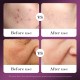لوسیون ضد پیری کلاژن و ترمیم کننده عصاره حلزون سادور SADOER SNAIL REORGANIZE COLLAGEN LOTION