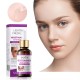 سرم روشن کننده و ضد کک و مک سادور SADOER NICOTINAMIDE WHITENING FRECKLE ESSENCE