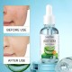 سرم آبرسان و مرطوب کننده عصاره آلوئه ورا سادور SADOER ALOE VERA HYDRATE MOISTURIZE FACE SERUM