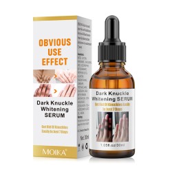 سرم روشن کننده پوست دست و بدن مویکا MOIKA DARK KNUCKLE WHITENING SERUM