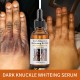 سرم روشن کننده پوست دست و بدن مویکا MOIKA DARK KNUCKLE WHITENING SERUM