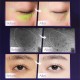 کرم دور چشم سه غلطکی ضد چین و چروک و ترمیم کننده رتینول اچ ای اچ HIH ANTI WRINKLE DELICATE REVITALIZING EYE CREAM