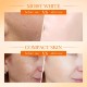 کرم سفید و روشن کننده ویتامین C سادور حاوی نیاسینامید و رتینول SADOER VITAMIN C WHITEN CREAM NOURISH HYDRATE NIACINAMID RETINOL