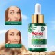 سرم ضد جوش و آکنه و کنترل چربی پوست عصاره چای سبز سادور SADOER TEA TREE ACNES OIL CONTROL FACE SERUM