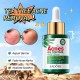 سرم ضد جوش و آکنه و کنترل چربی پوست عصاره چای سبز سادور SADOER TEA TREE ACNES OIL CONTROL FACE SERUM