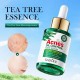 سرم ضد جوش و آکنه و کنترل چربی پوست عصاره چای سبز سادور SADOER TEA TREE ACNES OIL CONTROL FACE SERUM