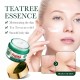 کرم ضد جوش و آکنه و کنترل چربی پوست عصاره چای سبز سادور SADOER TEA TREE ACNES OIL CONTROL FACE CREAM