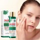 تونر ضد جوش و آکنه و کنترل چربی پوست عصاره چای سبز سادور SADOER TEA TREE ACNES OIL CONTROL FACE TONER