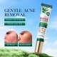 کرم ژلی دور چشم ضد جوش و آکنه و کنترل چربی پوست عصاره چای سبز سادور SADOER TEA TREE ACNES OIL CONTROL ANTI ACNE GEL