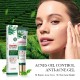 کرم ژلی دور چشم ضد جوش و آکنه و کنترل چربی پوست عصاره چای سبز سادور SADOER TEA TREE ACNES OIL CONTROL ANTI ACNE GEL